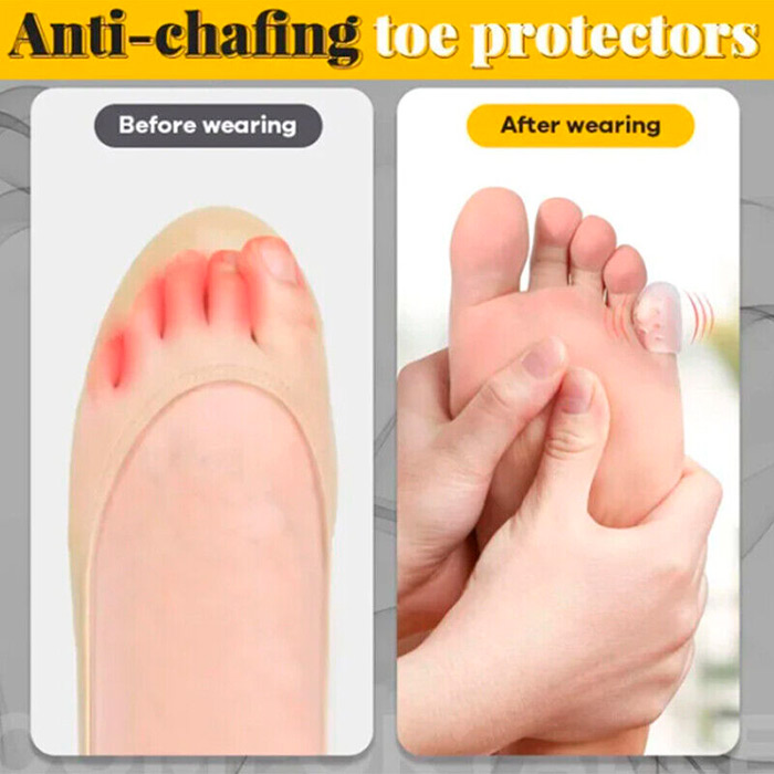 ToeProtector, silikonska zaščita za prste na nogah  (10 kosov) - Image 5