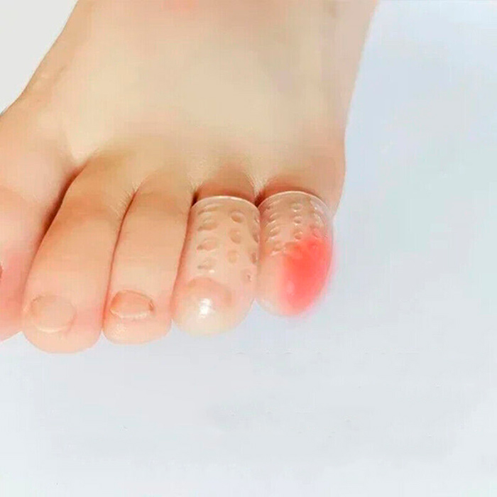 ToeProtector, silikonska zaščita za prste na nogah  (10 kosov) - Image 8
